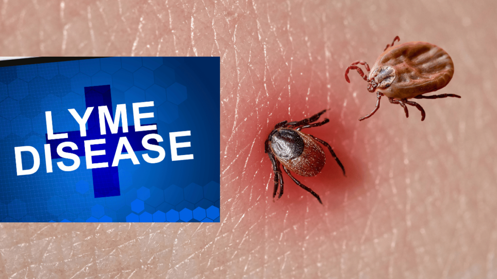 Stages of Lyme Disease Symptoms