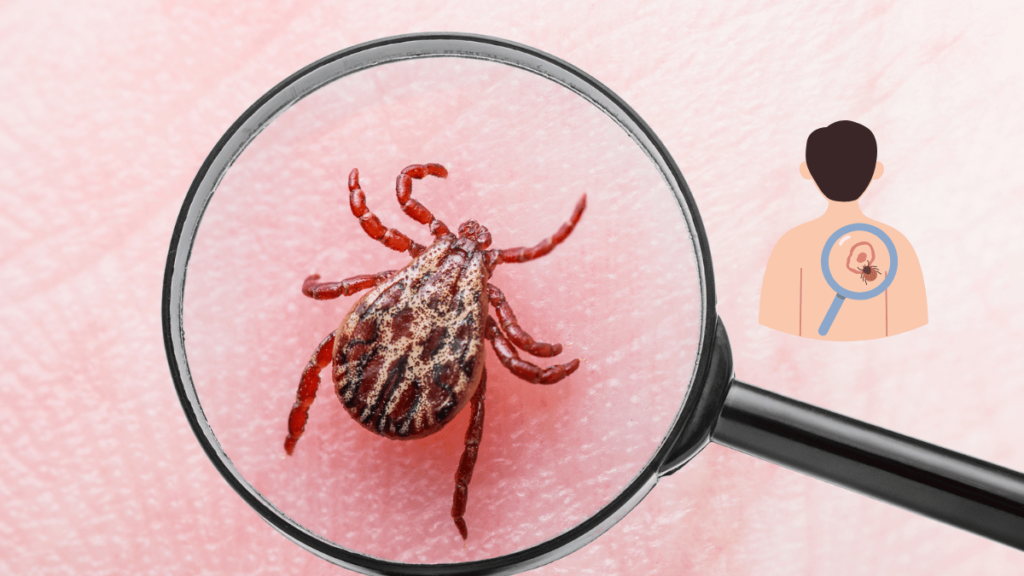 Recognizing Lyme Disease Symptoms Early Signs and Diagnosis